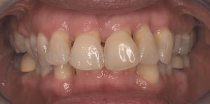 מרפאת גזית – רפפורט אורתודונטיה מומחים ליישור שיניים