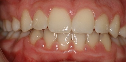 מרפאת גזית – רפפורט אורתודונטיה מומחים ליישור שיניים